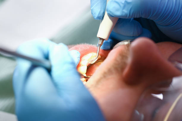Best Weekend Emergency Dentist in Fortville, IN