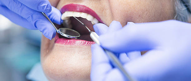Best Emergency Root Canal Treatment in Fortville, IN